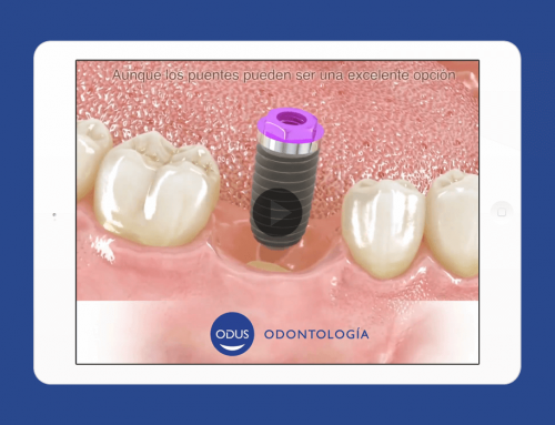 Odus – Video de cómo cepillar los dientes correctamente