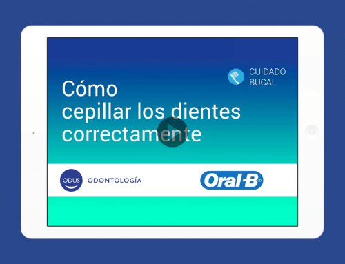 Odus – Video de Prótesis dental fija